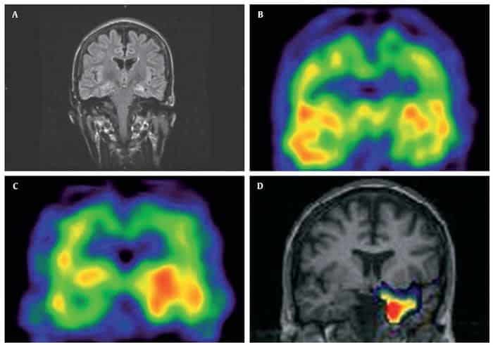 ejercicio cerebro